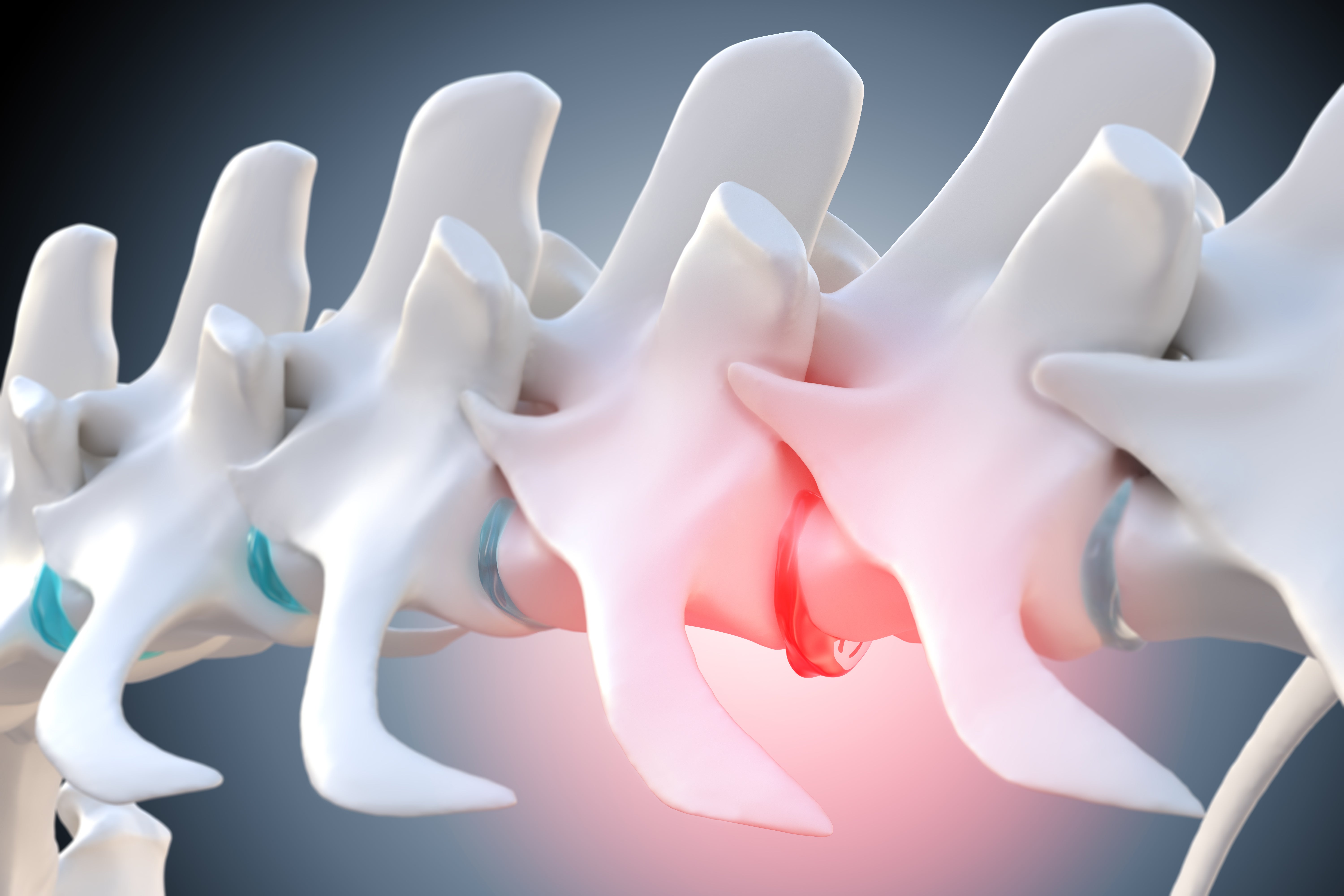 Managing Lifelong Spinal Arthritis in Dogs:  Is Medication the Only Option?